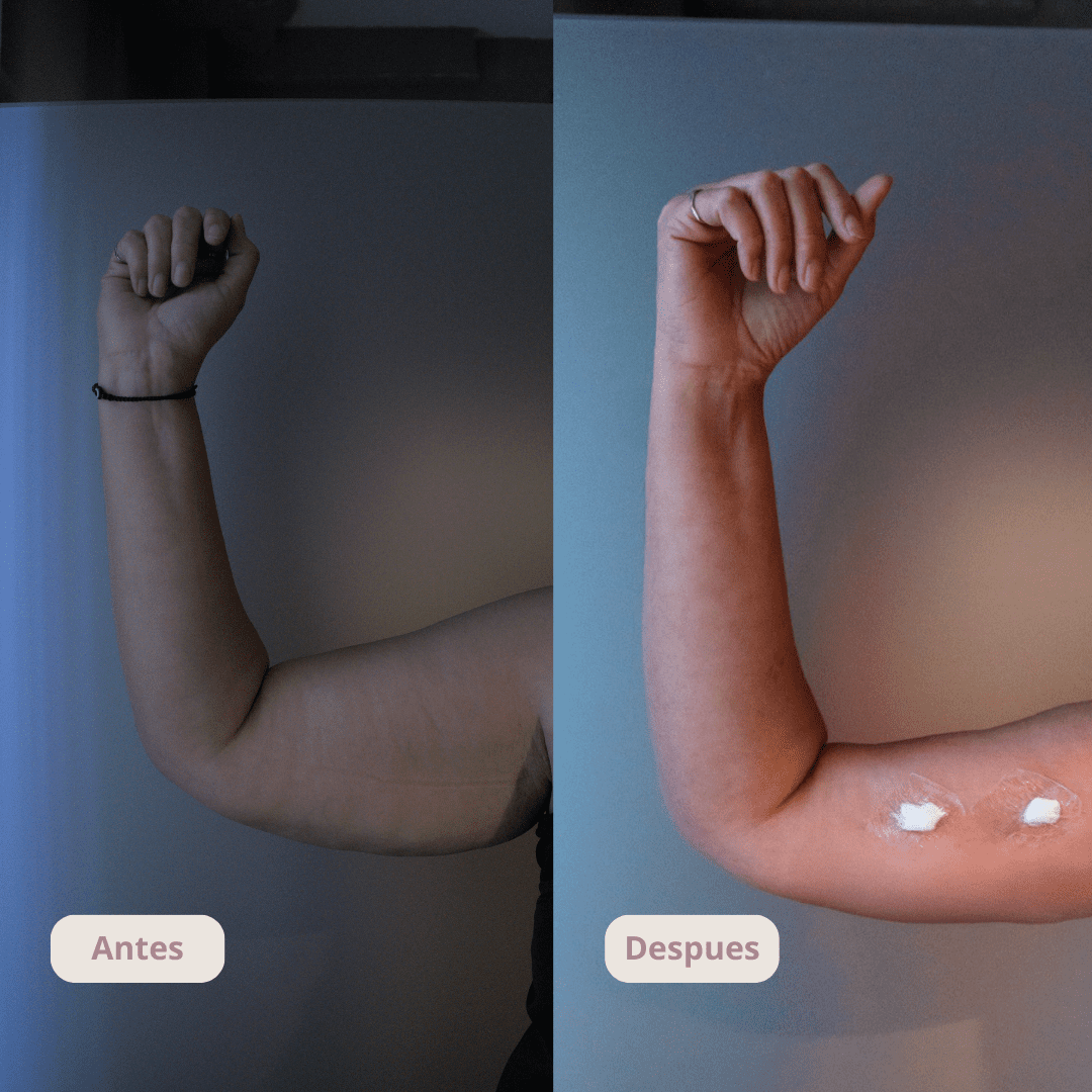 Resultado del tratamiento