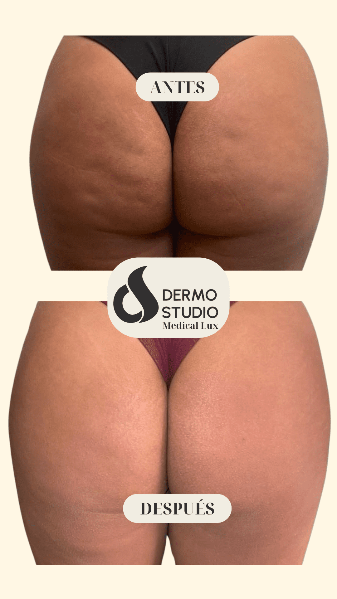 Resultado del tratamiento