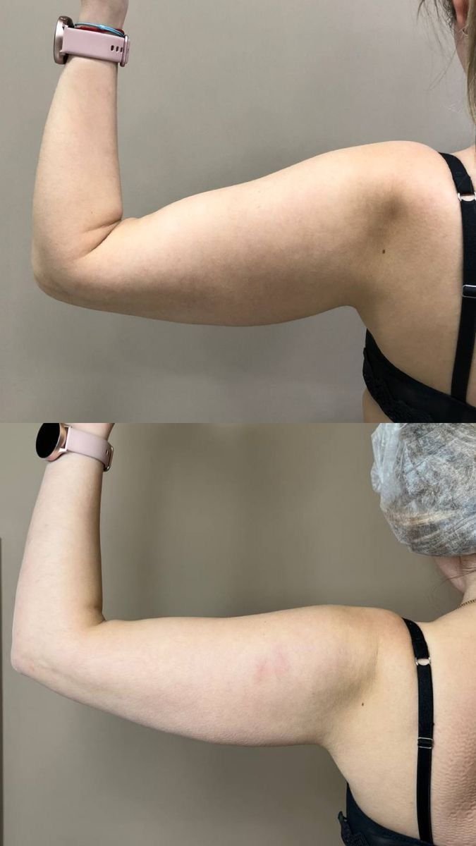 Resultado del tratamiento