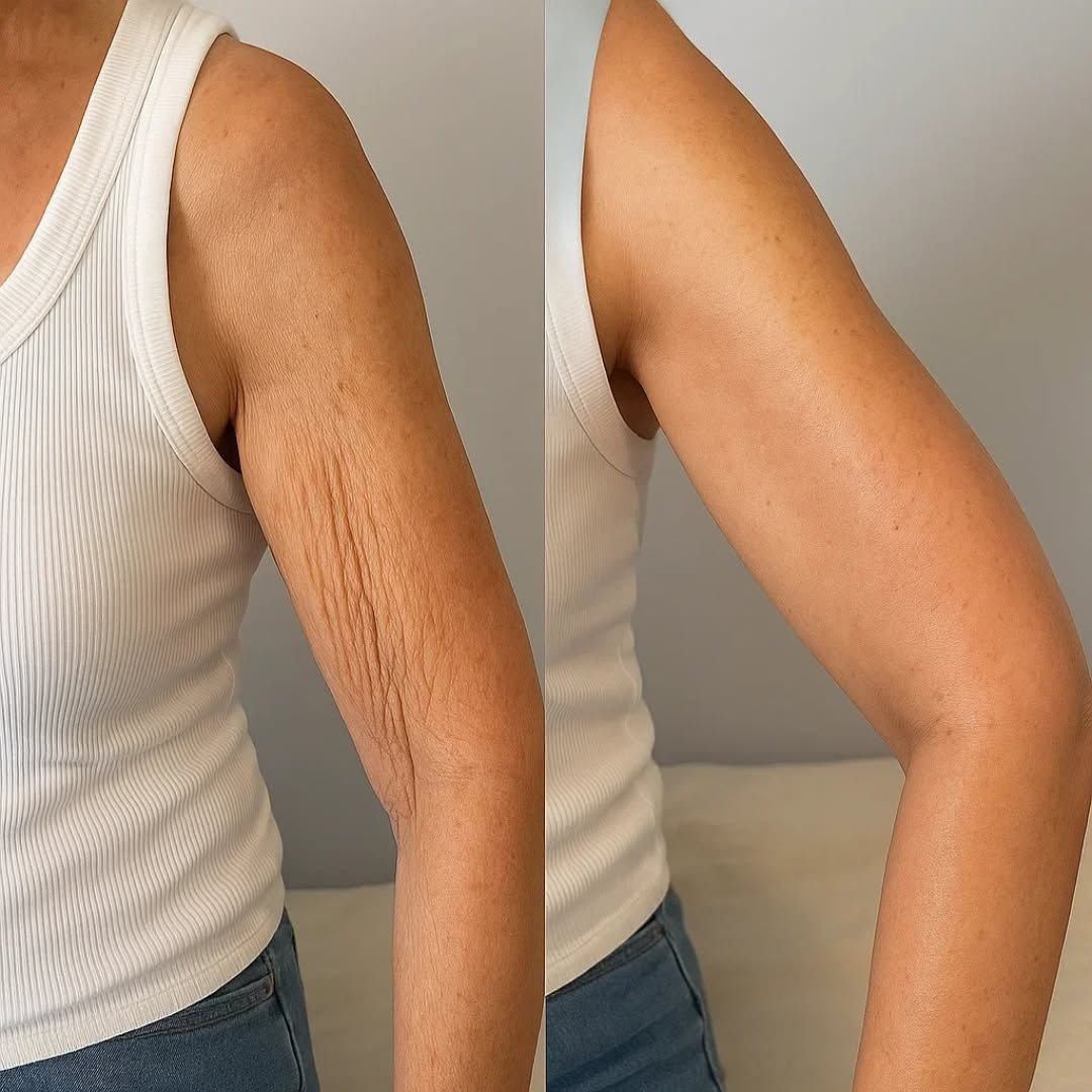 Resultado del tratamiento